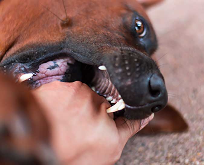 Dog Bite Injury